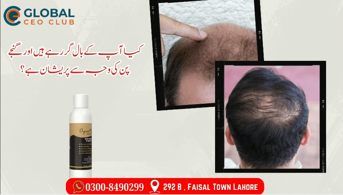 Herbal Hair Oil